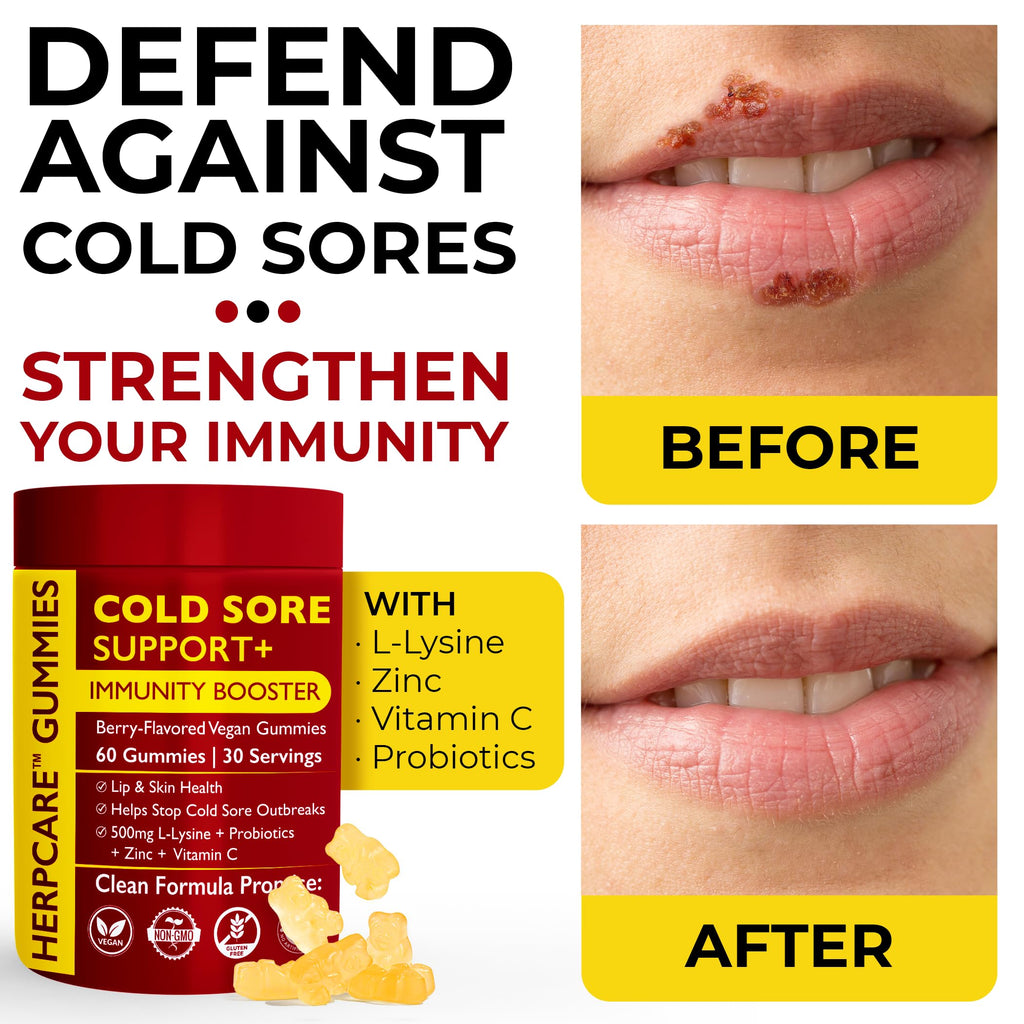 Cold Sore Treatment with L-Lysine, Zinc & Vitamin C E18798