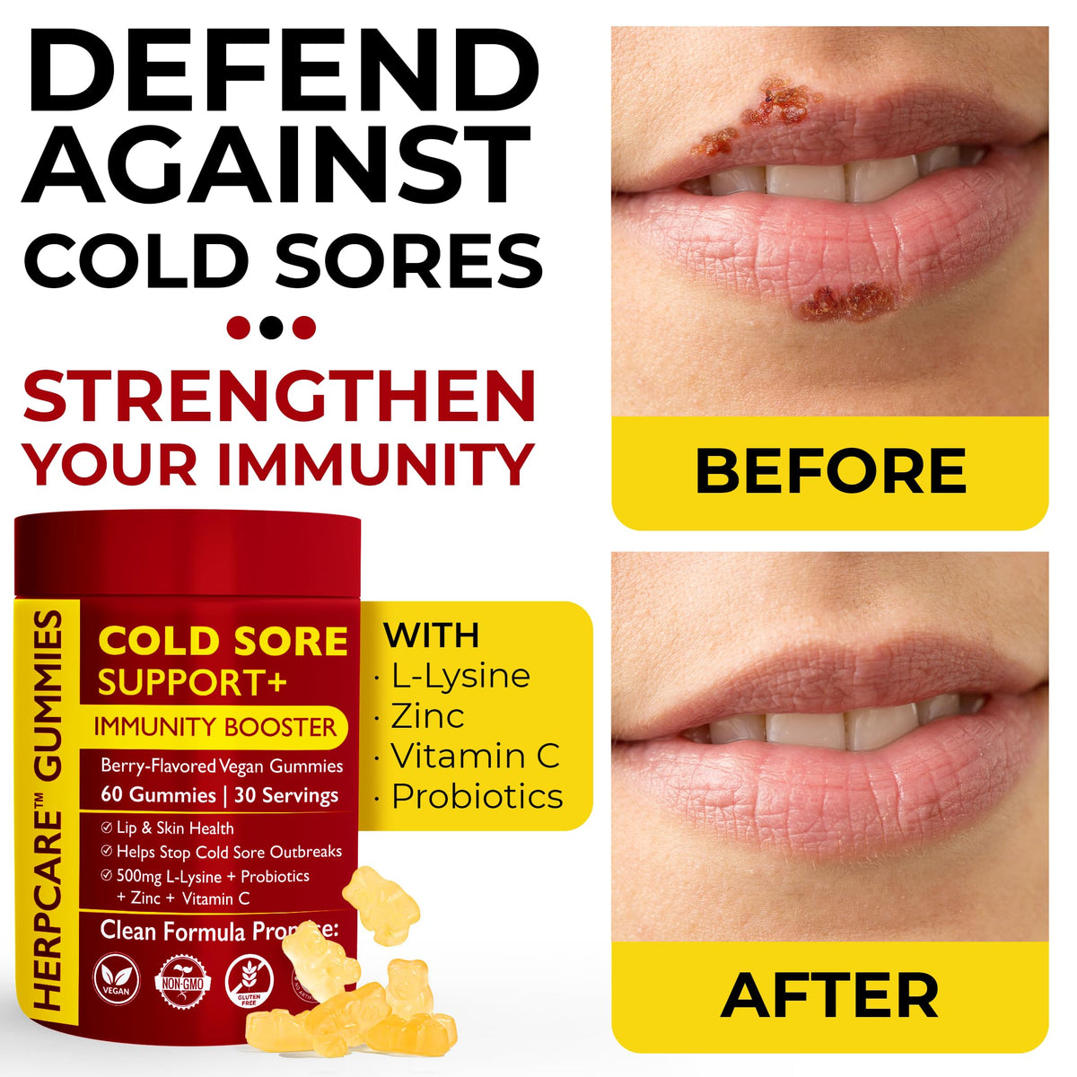 Cold Sore Treatment with L-Lysine, Zinc & Vitamin C E18798